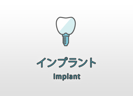 インプラント