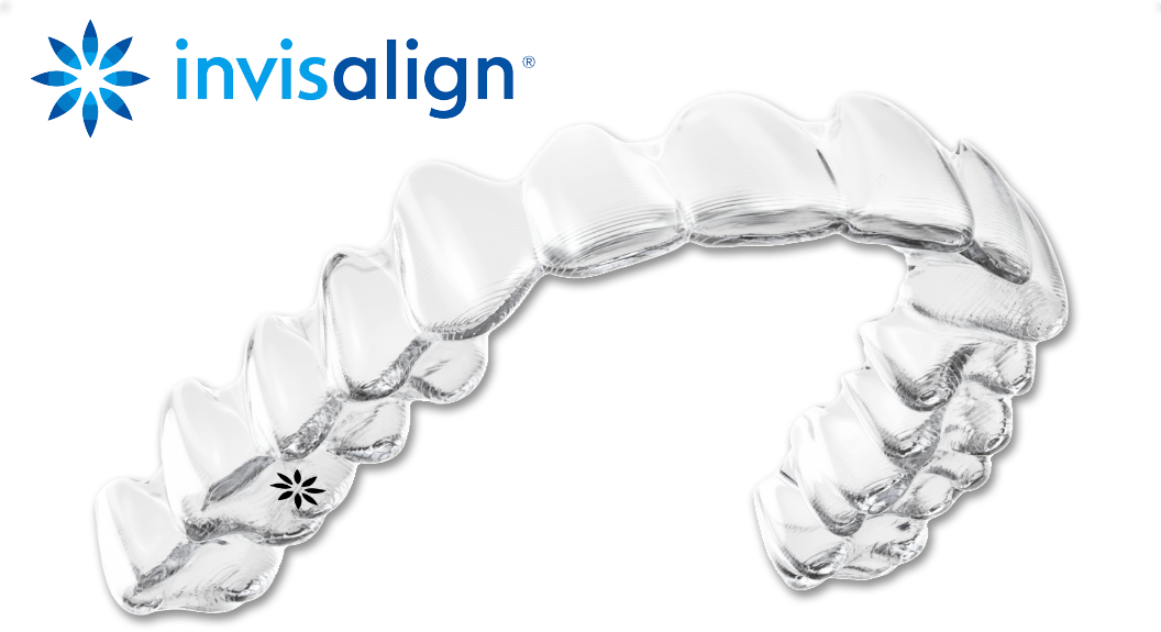 インビザライン